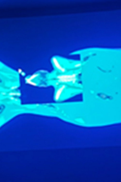 X-Ray Katx